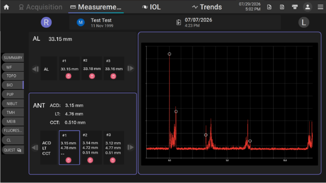 MYAH PRO Biometry