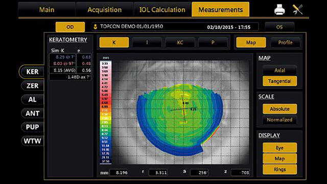 KERATOMETRY