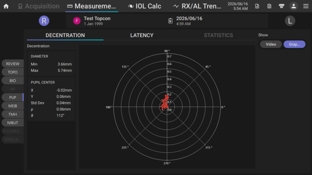 Pupillometry