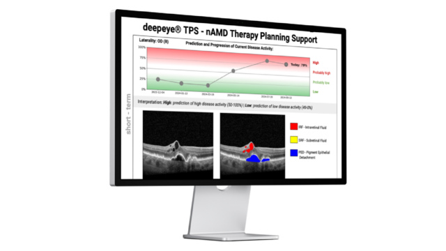 Topcon Healthcare and deepeye Medical Partner to Bring AI-Guided Retinal Therapy Planning Across Europe