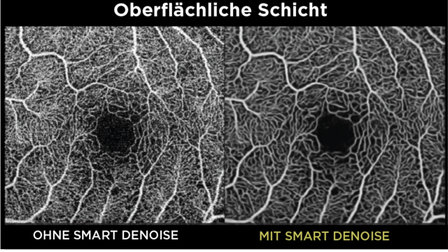 smartdenoise