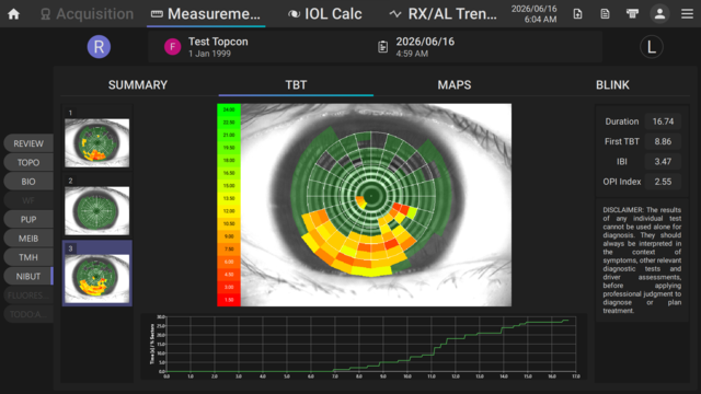 Ocular Surface Assessment Tools