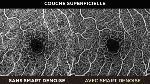 Smart Denoise