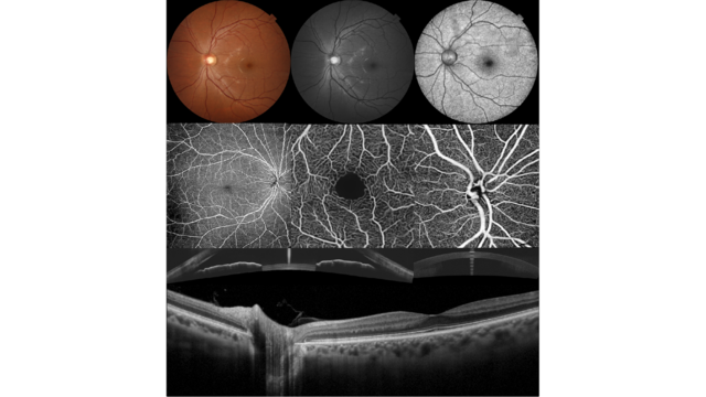 Multimodal imaging
