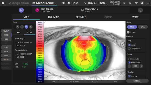 MYAH PRO Keratoconus Screening