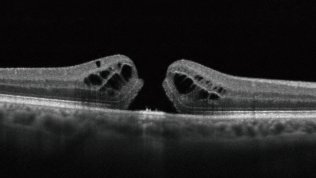 The Ophtalmologist - Maestro2