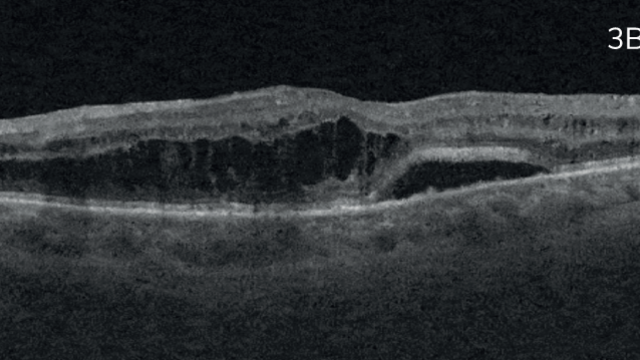 The Ophtalmologist  - PixelSmart et cas cliniques