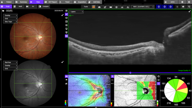 3D Wide Scan