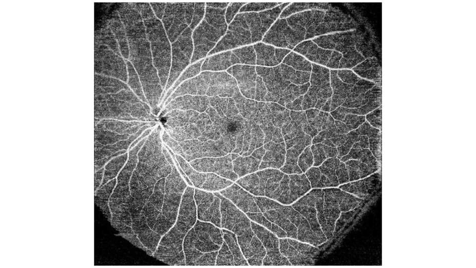 Topcon Scan Pattern Discover Triton from Topcon Healthcare