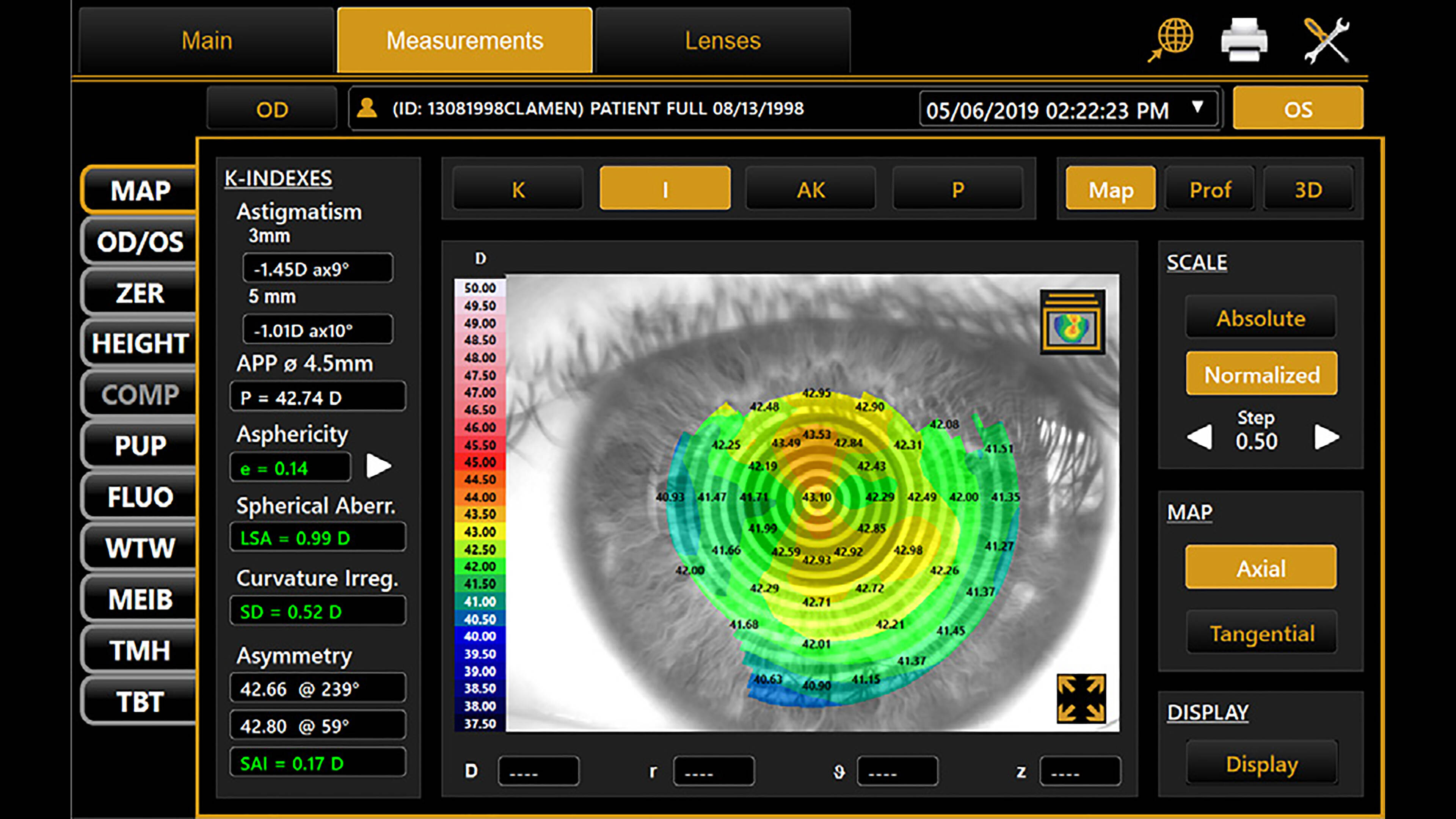 CA-800 - Topcon Healthcare