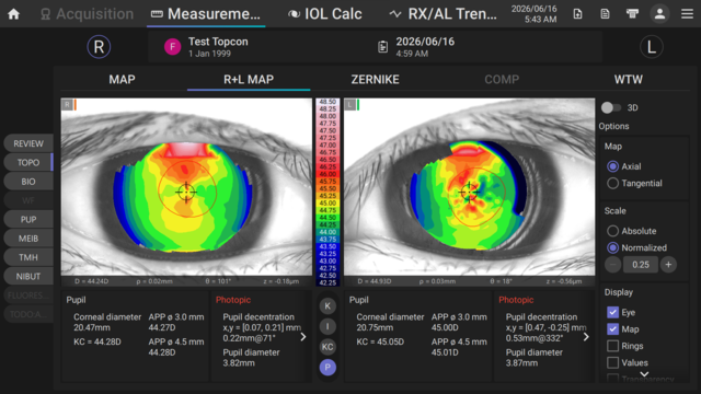 Corneal topography