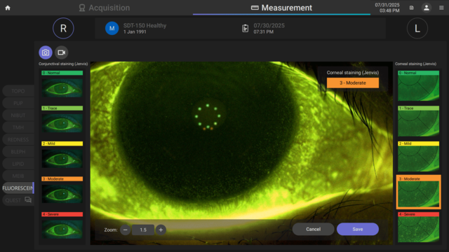 fluorescein imaging and video