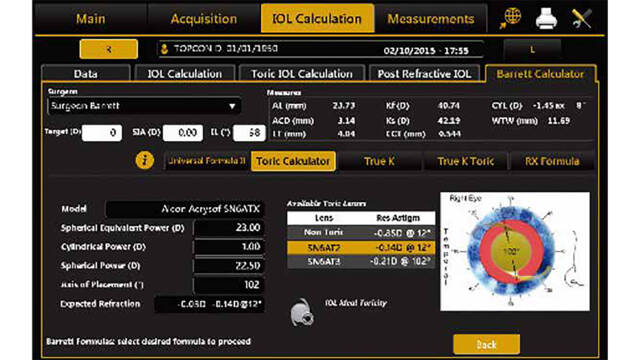 IOL calculation