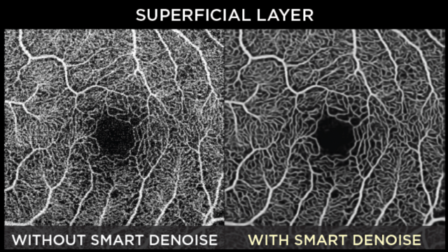 smartdenoise