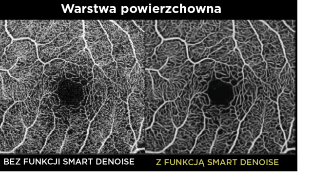 Smart Denoise