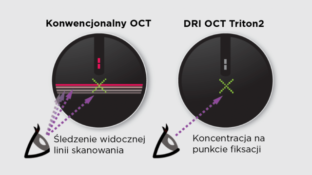 Niewidoczne linie skanowania