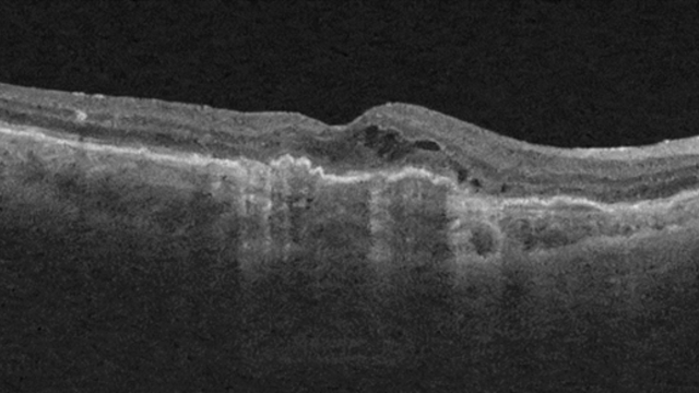 The Ophtalmologist - Triton